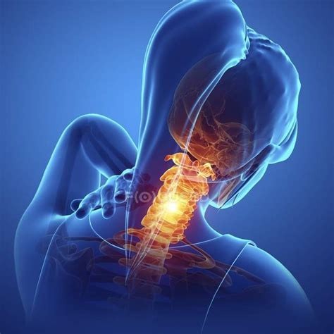 Neck Pain and the Brain: Exploring Connections and Solutions