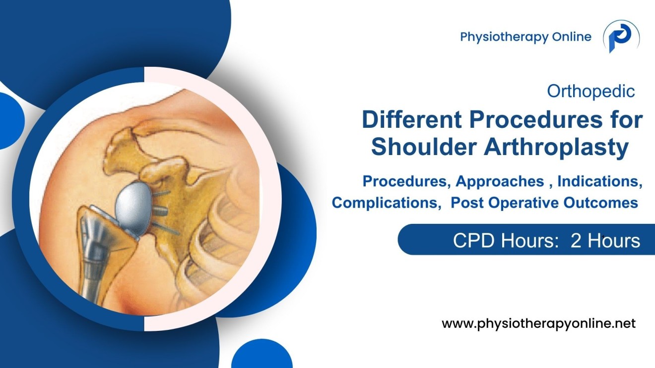 Surgical Approaches in Shoulder Arthroplasty - Procedures Guidelines