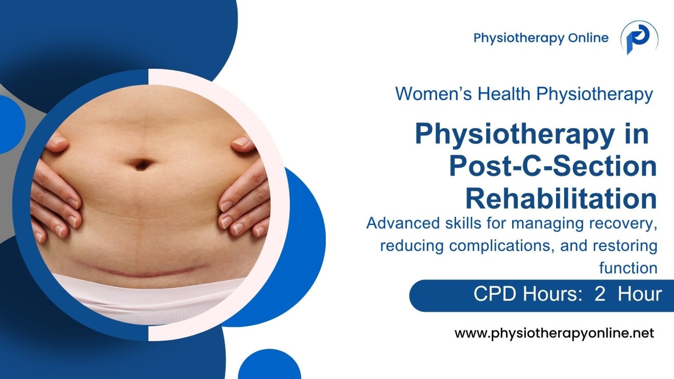 Physiotherapy Management of C-Section Patients: Evidence-Based Approach