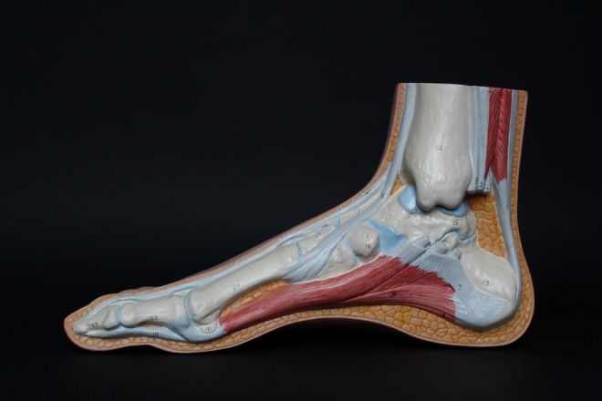 Plantar Fasciitis _ Evidence Based Physiotherapy Management